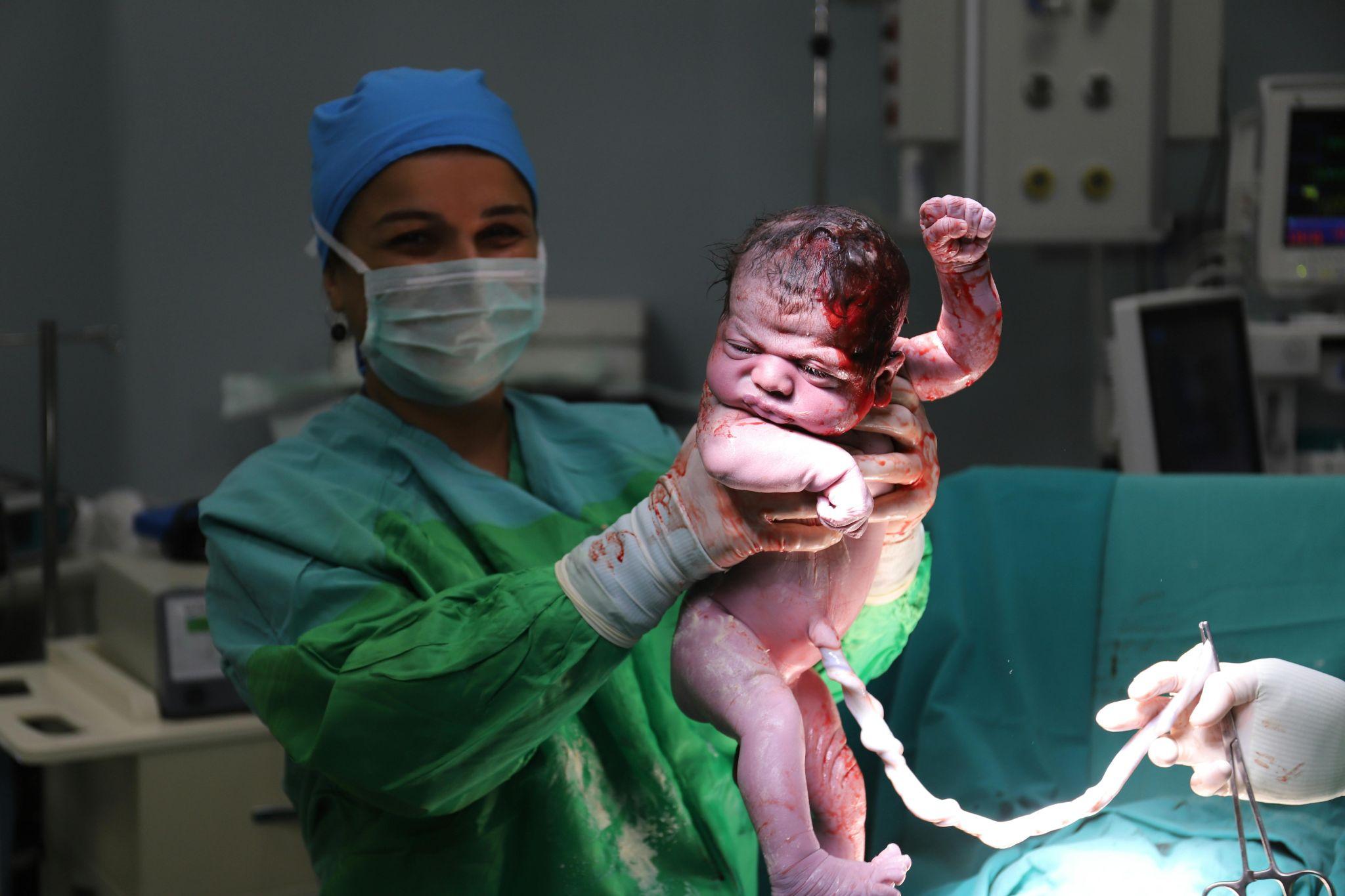 A healthcare professional holds a newborn baby with an umbilical cord still attached, moments after birth, in a medical setting. Both the professional and the baby are covered in fluids, highlighting the importance of discussing compensation options for birth-related injuries.